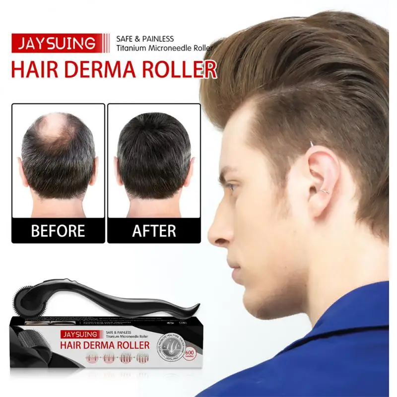 

Натуральные мужские волосы для роста бороды Дерма ролик микро-игла дермароллер для роста волос против выпадения волос лечение для мужчин t