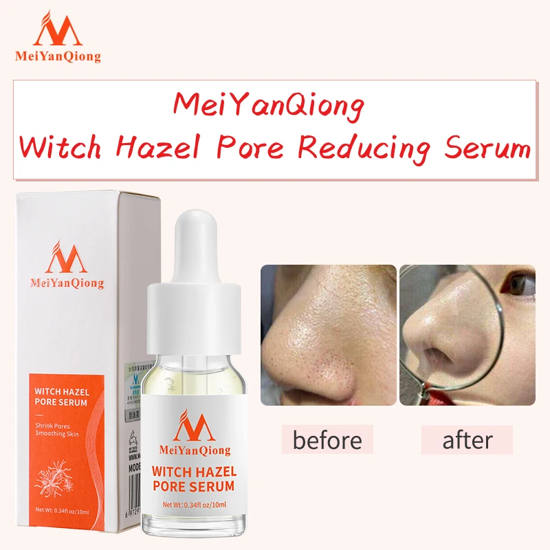 Фото Эссенция для сужения пор MeiYanQiong, эффективно чистая пора отбеливает кожу, восстанавливает влагу, сужает поры №2