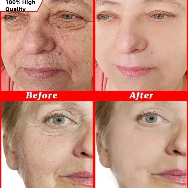 Новинка 20 шт. капсулы с гиалуроновой кислотой сыворотка для лица тонкая линия