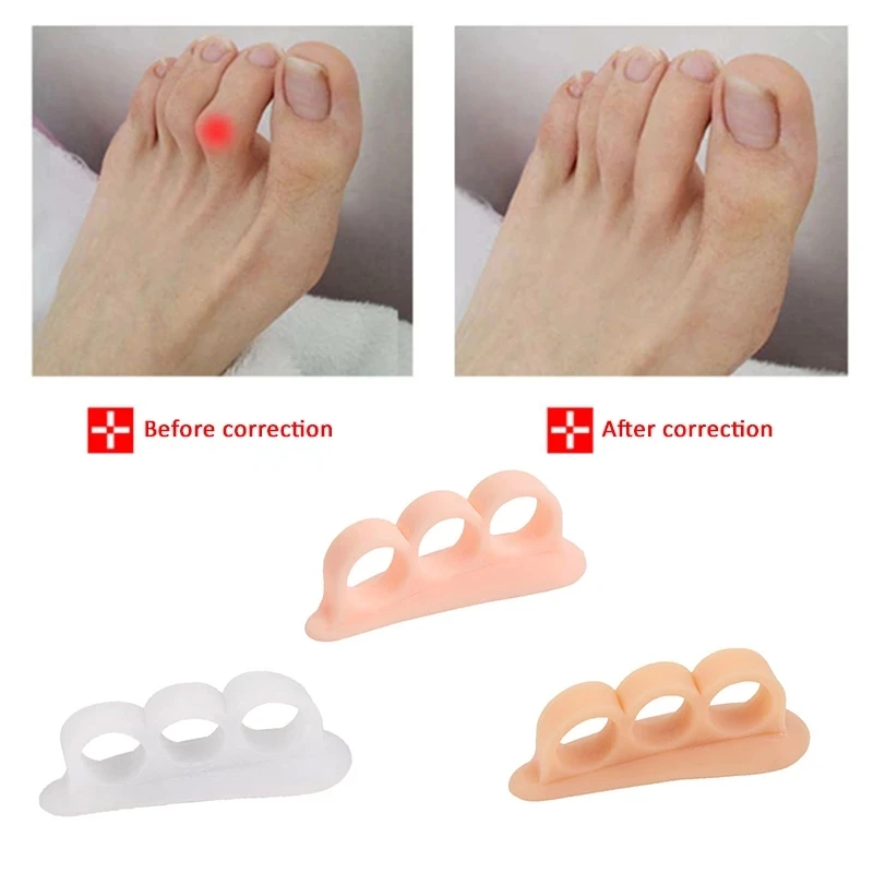 

25 Pairs Hammer Toe Cushions Toe Spacers Gel Eliminate Pressure And Friction Toe Pads Corrector Straightener For Claw Toes