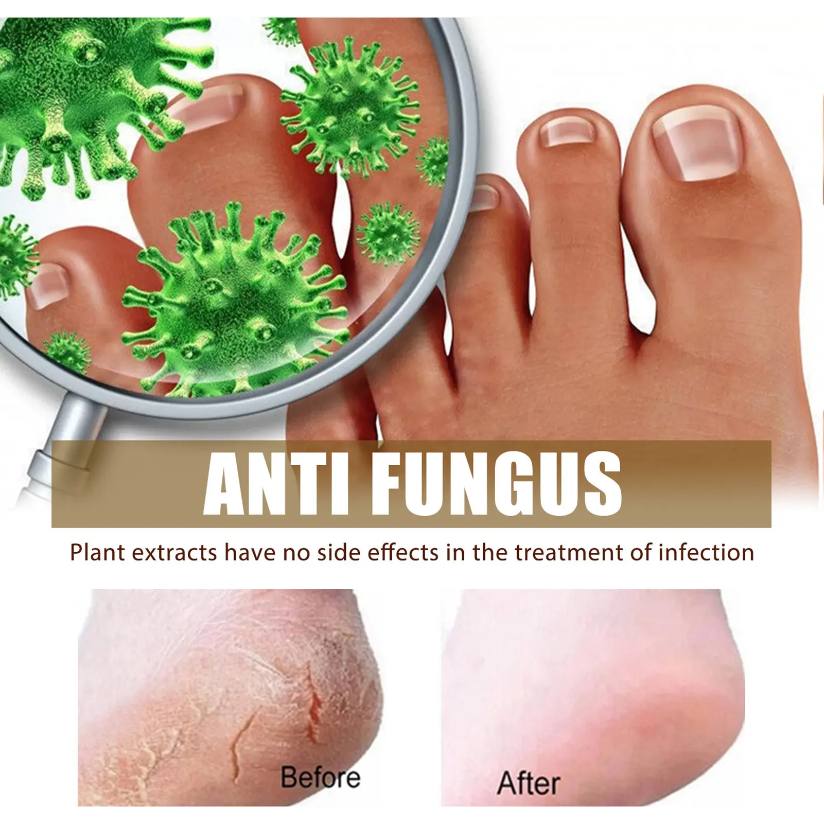 

Herbal Effective Foot Spray Anti Fungals Infections Repair Dry Crack Foot Odor Foot Care Foot Spray For Smelly Feet