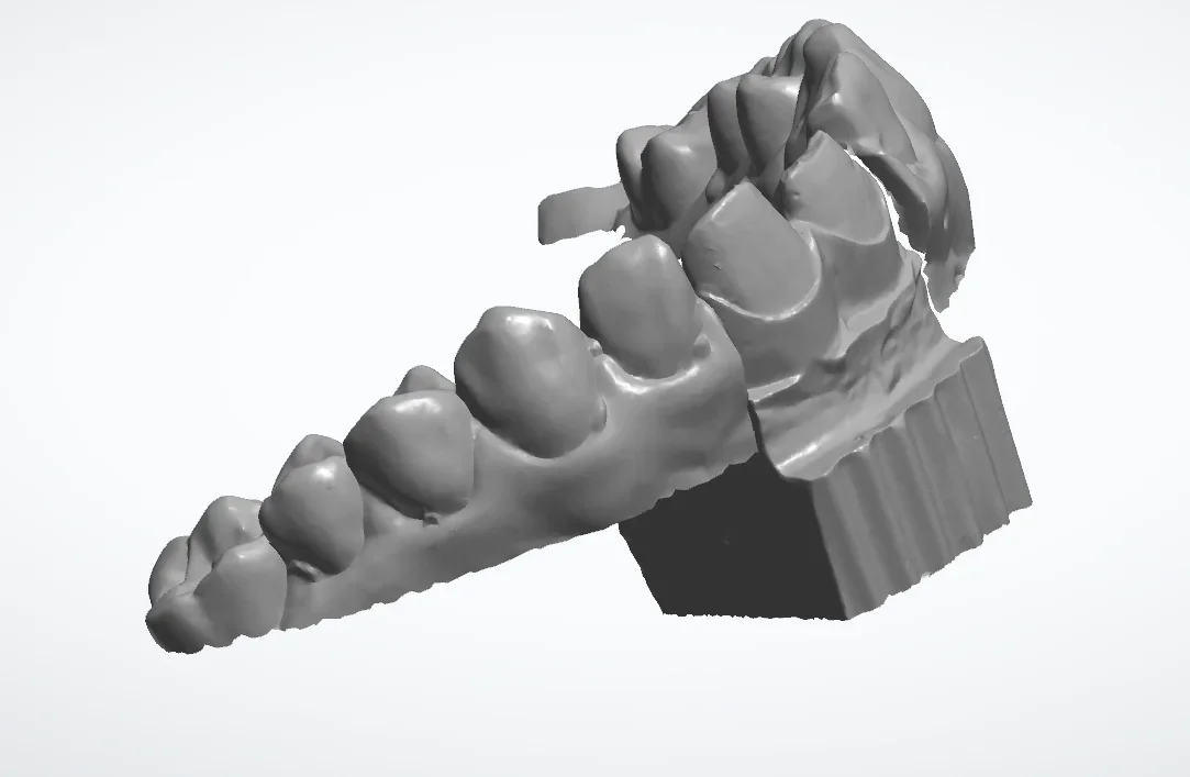 Новый стоматологический 3D-сканер Demetdent