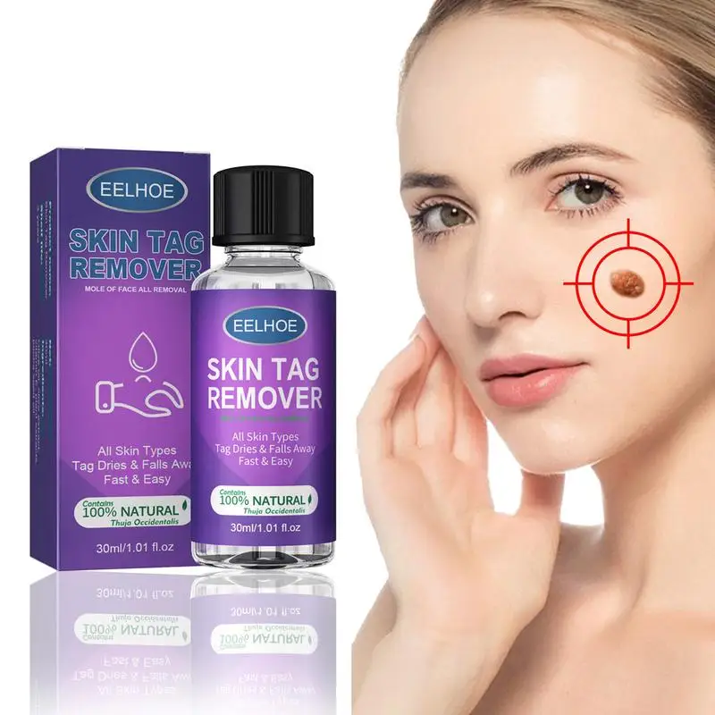 

Wart Remover Liquid Anti Verruca Remedy Liquid Quickly Remove Skin Wart And Mole Painless Skin Care Liquid Skin Tag Remover