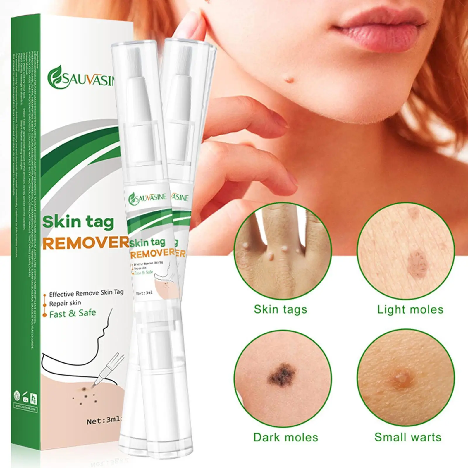 

2pcs Effective Skin Tag Remover Fast Remove Mole & Genital Wart Anti Foot Corn Removal Warts Papillomas Rapidly Removes Moles