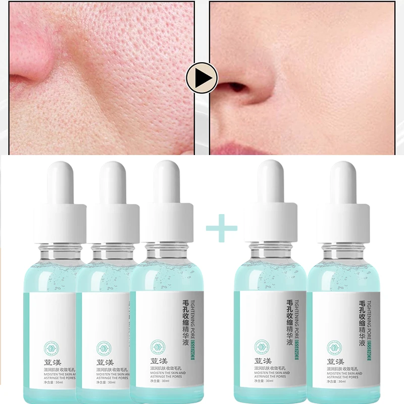 

Minimize Pore Shrinking Facial Serum Smooth Delicate Acne Scar Removal Oil Control Moisturizing Korean Skin Care Products 30ml