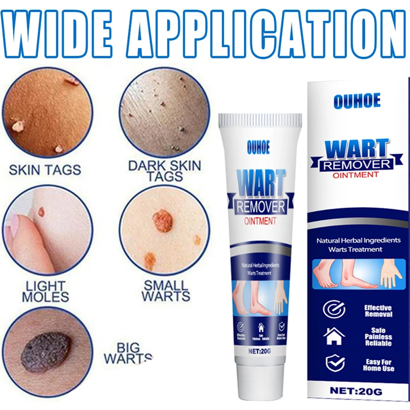 

20g Wart Removal Cream Wart Treatment Instant Removal Mole and Papillomas Foot Corn Repair Tool Natural Bacteriostatic cream