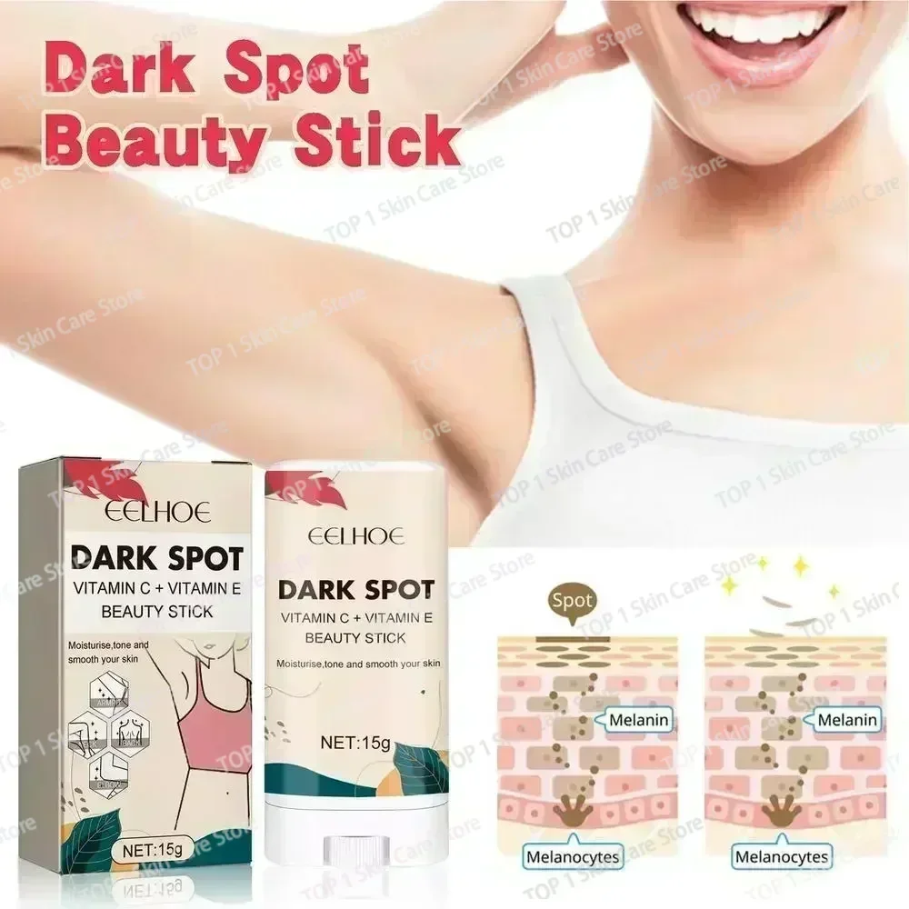 Горячие продажи отбеливающий крем для удаления темных пятен и корректора нежный