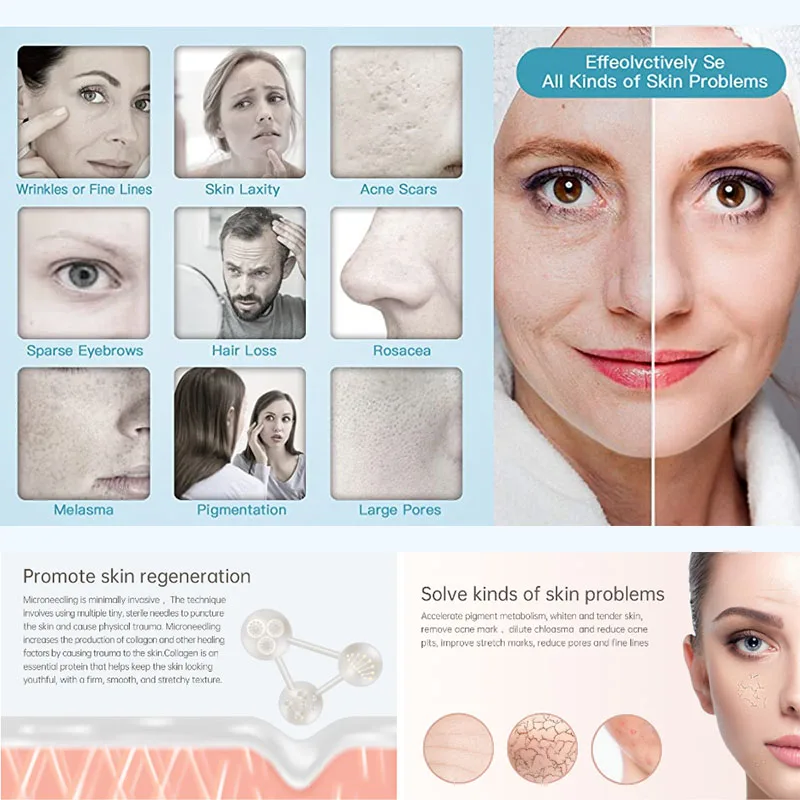 Рисунок 3 - ELON-YC Derma Pen X6