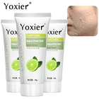 Yoxier 3 шт. очищающее средство для очистки кожи от акне и черных точек