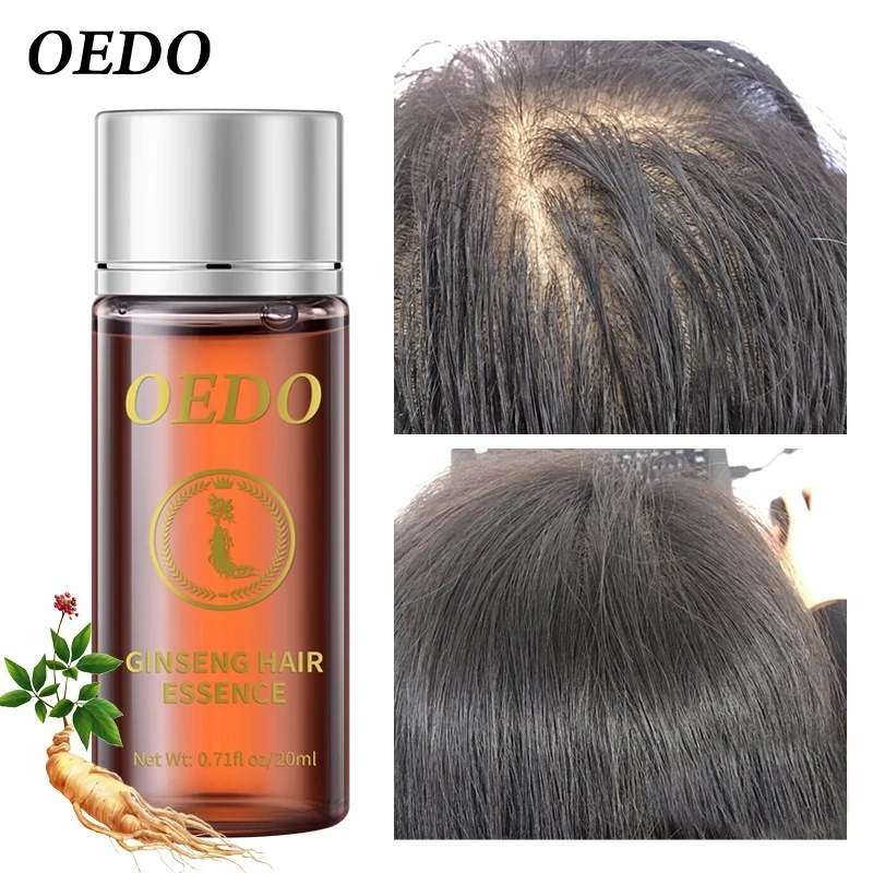 

OEDO Fast Hair Growth Ginseng Essential Oil Hair Preventing Moisturize and Repair Relieve Dryness Hair Care Dry Repair