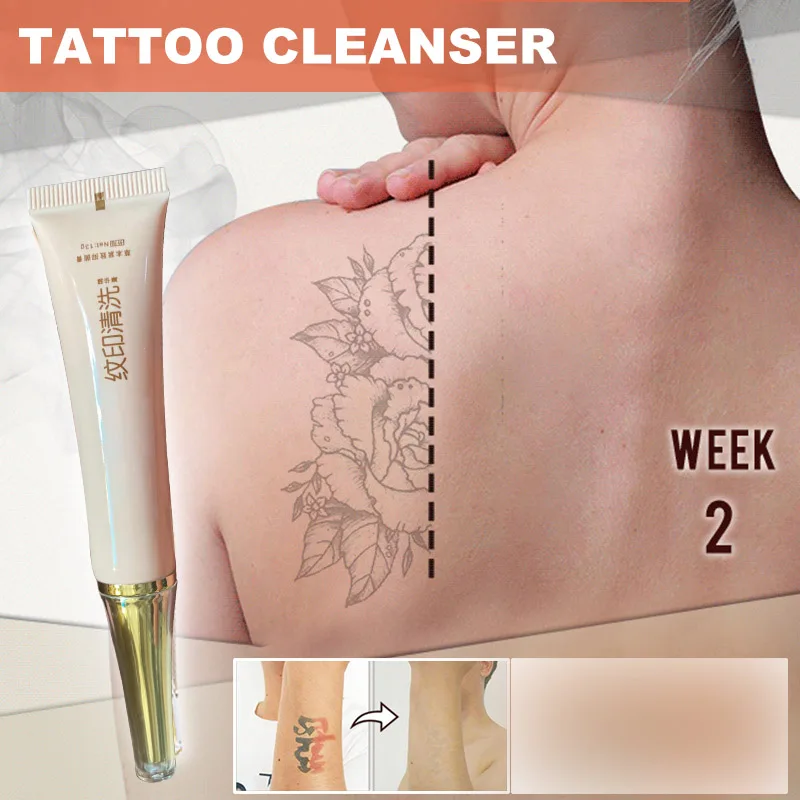

Tattoo Removal Cream Painless Remove Tattoo Ink Remover Without Scarring No Pain No Hurt Safe Gentle