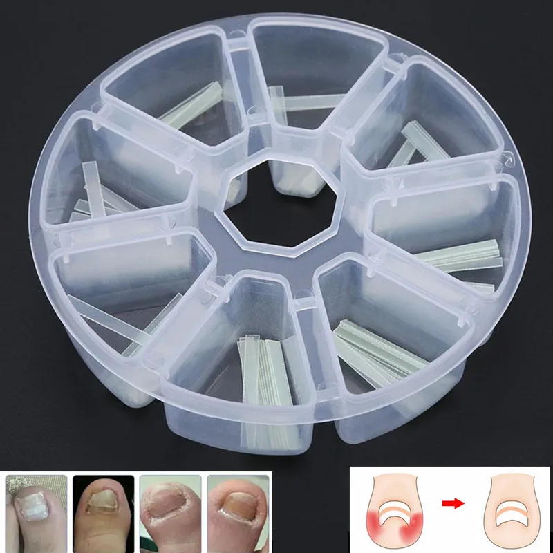 

120 pcs/box Ingrown Pedicure Toenail Straightening Clip Toe Nail Sticker Patch Correction Tool Thin Reduce Pain Eliminate Rednes