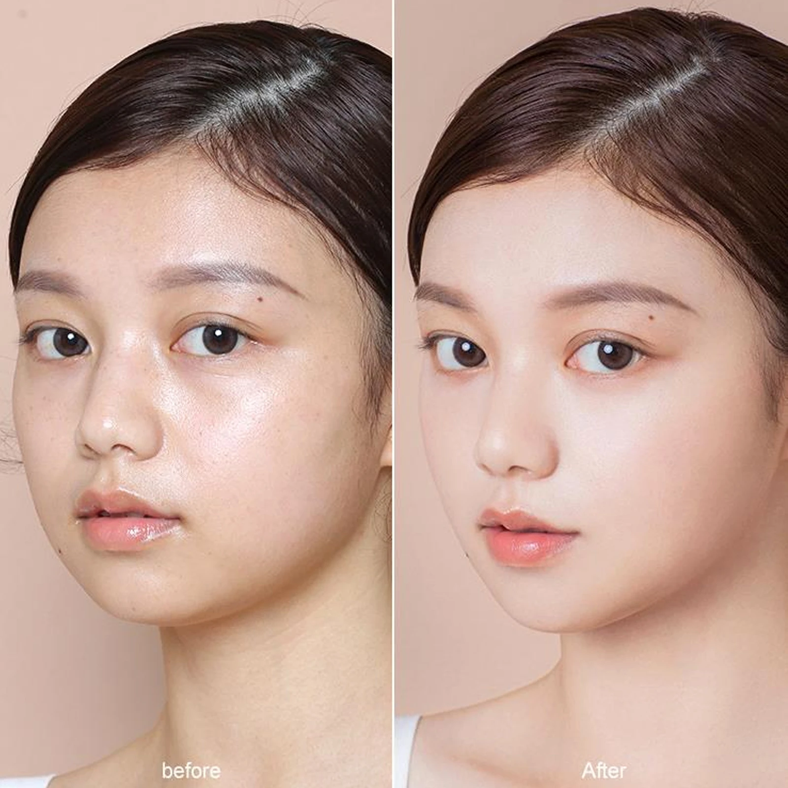 Face Filler Absorbable Collagen Protein Thread Lift Plump Silk Fibroin Line Carving Anti Aging Essence |
