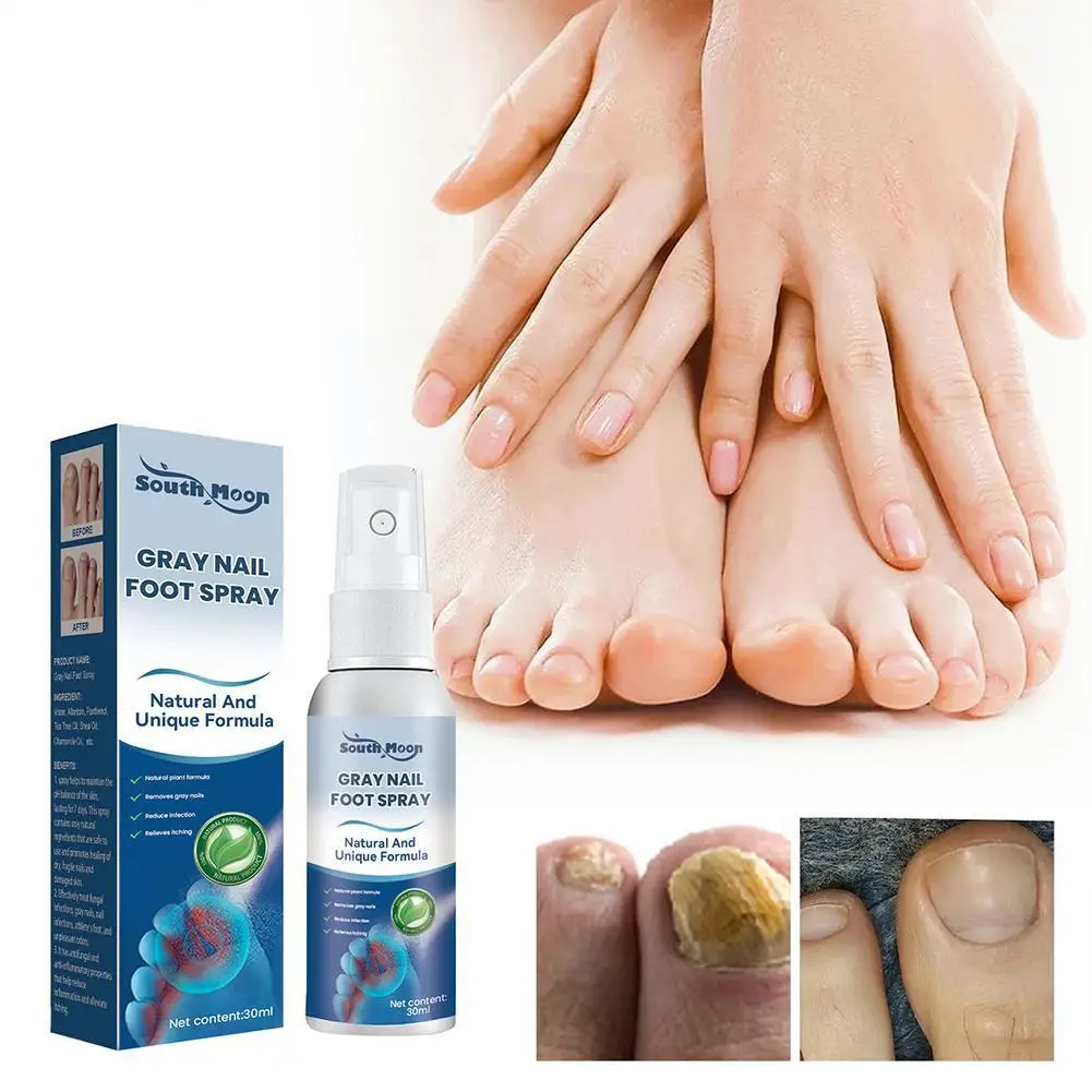 

30ml Effective Anti-Fungal Gray Nail Foot Spray Toenail And Hand Nail Repairs Spray Foot Care For Discolored Or Damaged Nai K2N4