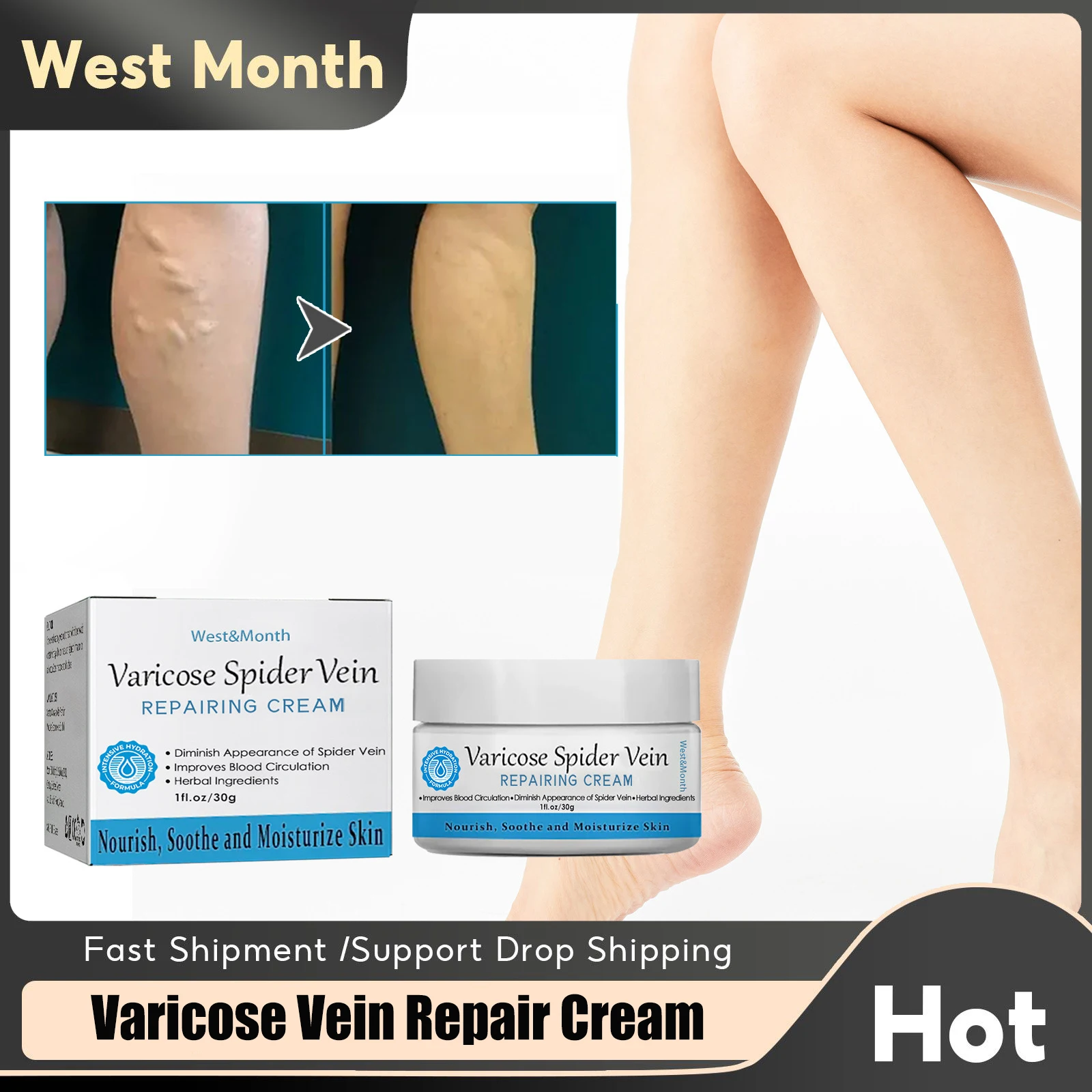 

Varicose Vein Treatment Cream Vasculitis Phlebitis Effective Relief Spider Earthworm Lumps Leg Cure Anti Swelling Pain Ointment