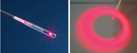 Медицинская хирургия 980 нм 1470 s геморрой анальный фистиль радиальное волокно