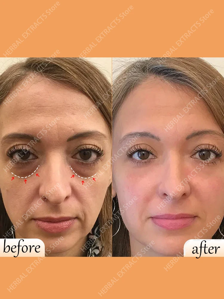 Сыворотка для области вокруг глаз от морщин и тёмных кругов