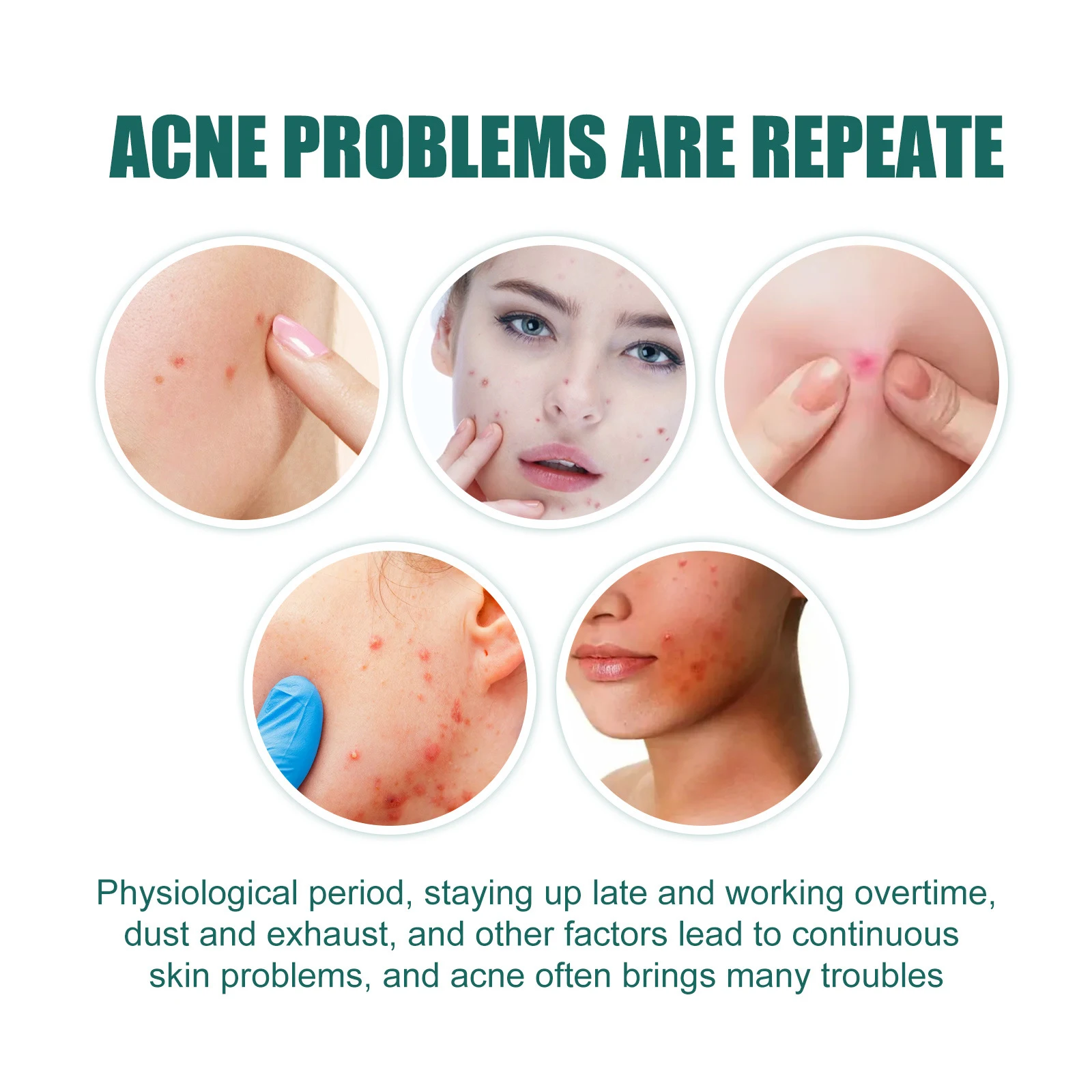 112 шт. водонепроницаемые разноцветные пластыри от прыщей и