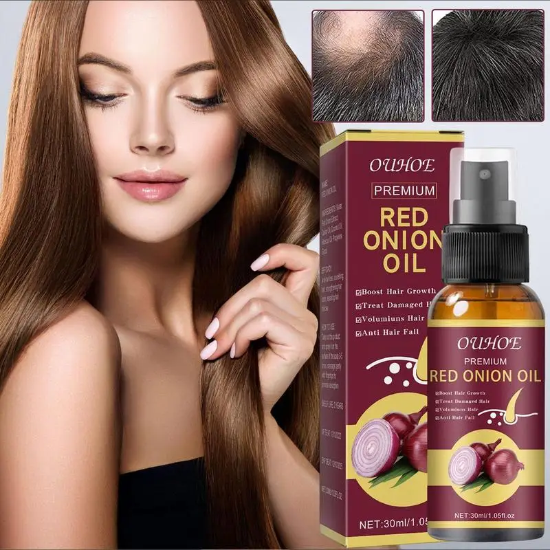 

Red Onion Hair Thicken Oil Spray 30ML Onion Black Seed Hair Serum Repair Hair Fall Dry Scalp Stimulate Strengthen Hair Root Oil