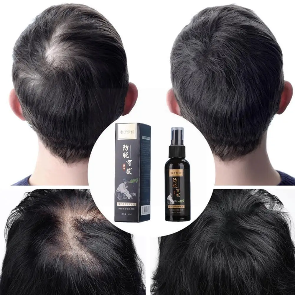 

60ml Ayurvedic Amazing Herbal Hair Oil Hair Growth Loss Hair O6k6