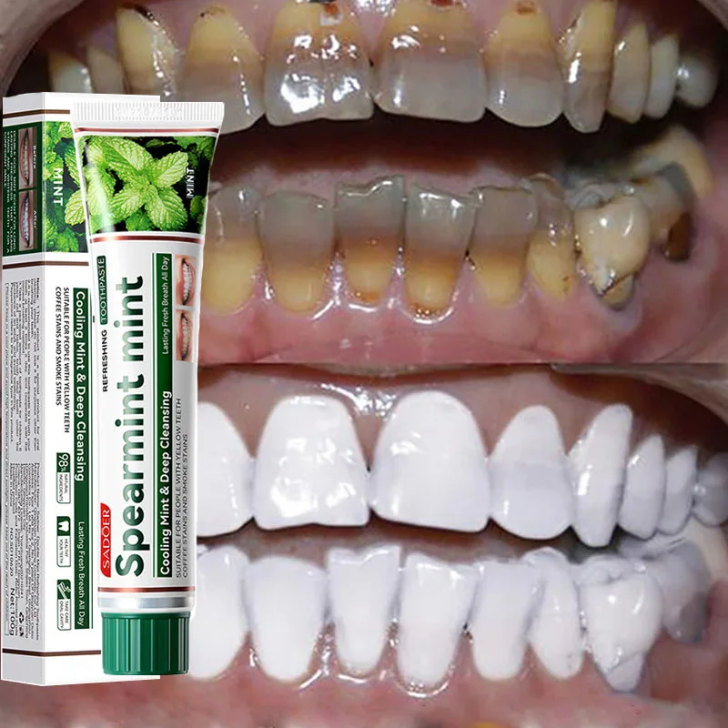 

Teeth Whitening Toothpaste Deep Cleansing Oral Hygiene Protect Gums Remove Bad Breath Plaque Stains Teeth Brightening Care 100G