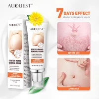 auquest stretch marks removal cream maternity scars acne remover pregnant women anti winkle aging skin firming body cream 45g