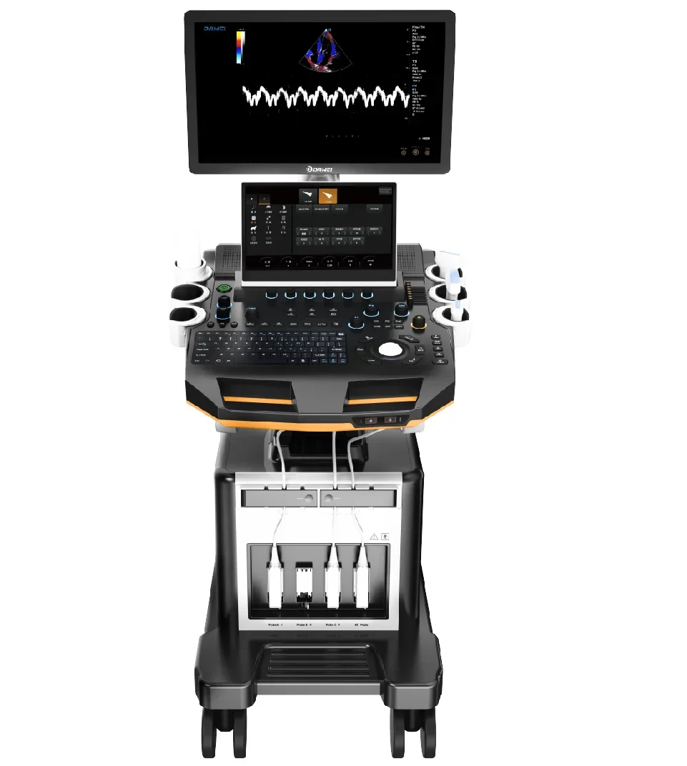 Рисунок 2 - T6-VET Trolley, Цветной Допплер 4D