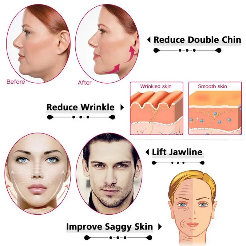 Электрический ремень для подтяжки лица Intelligent VFace Shaping Massager Double Chin Reducer Face Lifting Machine V-Face-Lift