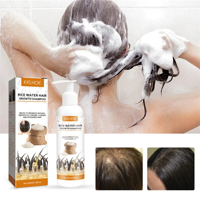 

Шампунь против выпадения волос Rice Secret, профессиональный Восстанавливающий шампунь для повреждения волос, роста волос, плотности, борьбы с зудом