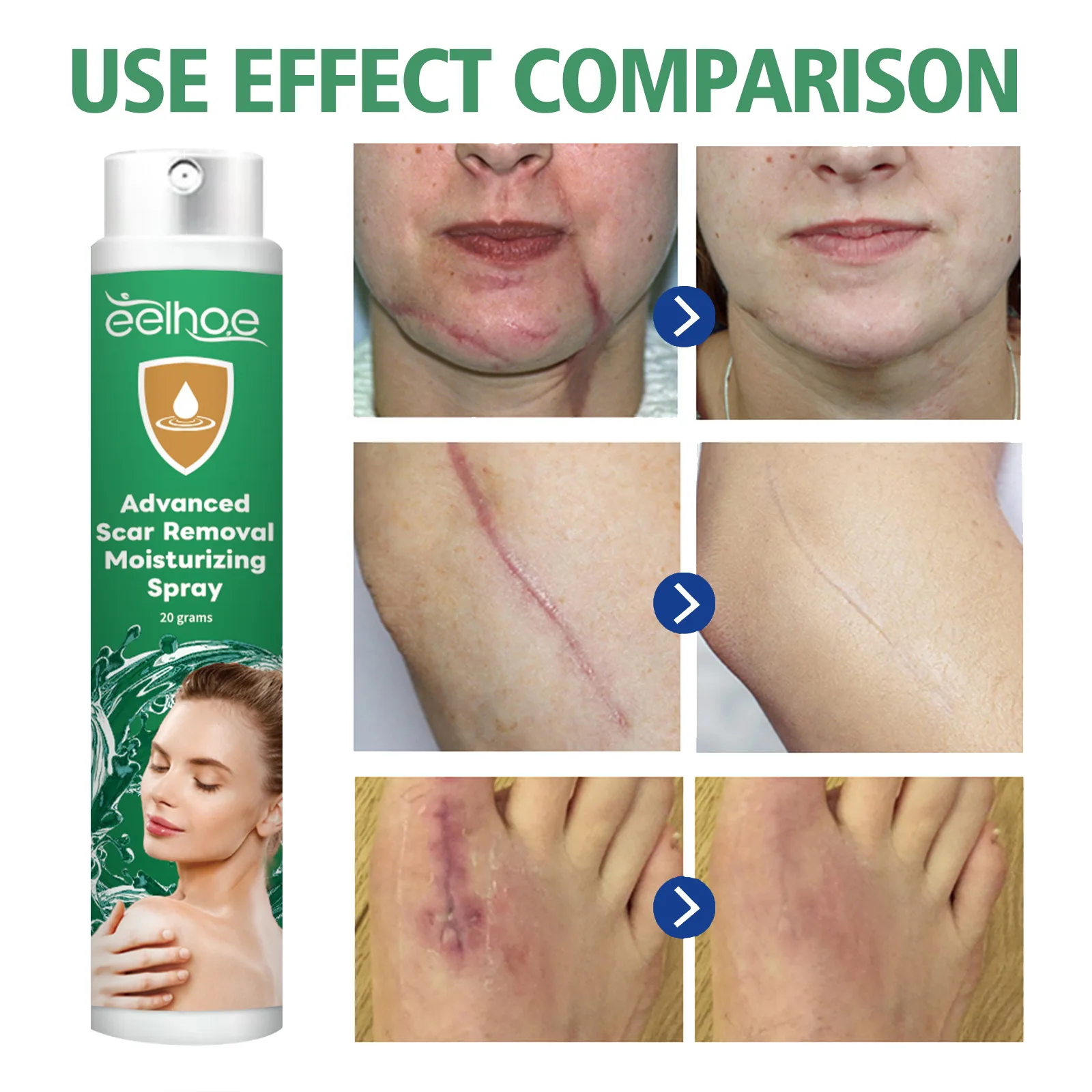 Рисунок 3 - Крем для удаления шрамов спрей