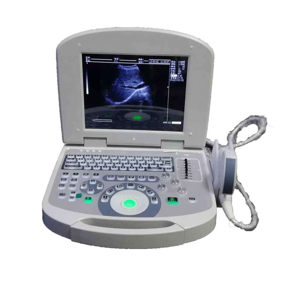 

laptop ultrasound machine and portable ultrasound