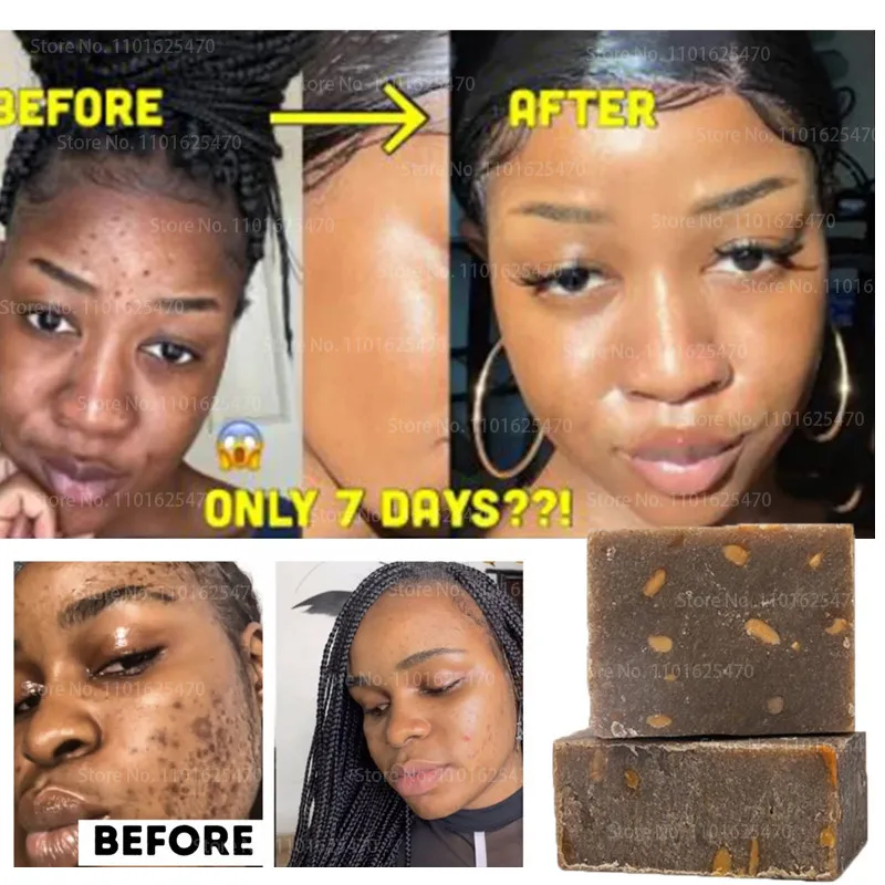 

African Black Soap Magic Anti Aging Reverse Beauty Moisturizing Shea Butter Natural Bath Body Treatment Acne Whitening Skin Care