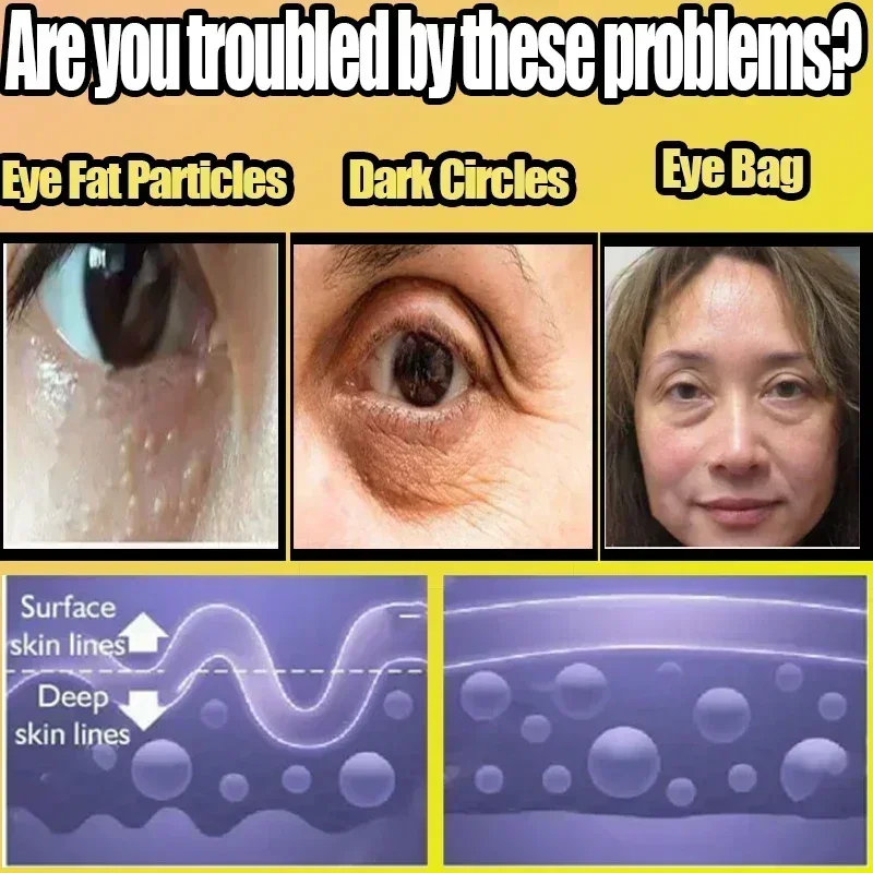 Крем для области вокруг глаз от Тёмных кругов и мешков под глазами