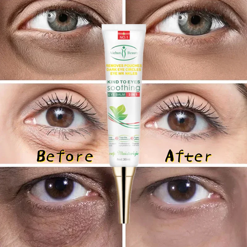 Крем для кожи вокруг глаз от Тёмных кругов и мешков под глазами