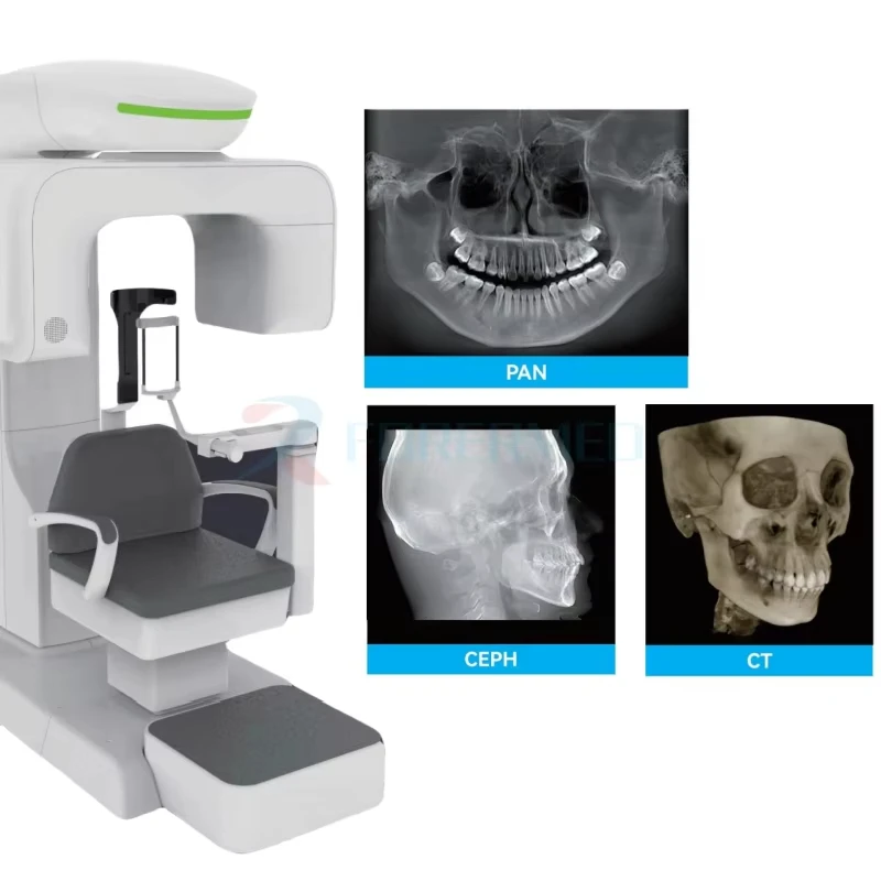 Фото Интеллектуальный 3D CBCT панорамный рентген-аппарат для стоматологии, универсальный дентальный цефалометрический рентген-аппарат №2