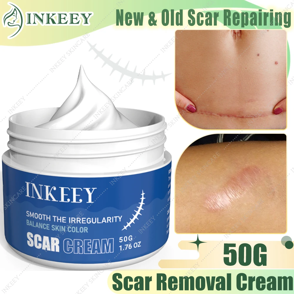 

Scar Removal Cream Scar Repairing Remove Acne Spots Treatment Stretch Marks Burn Surgical Scar Cream New Old Scars Gel Skin Care