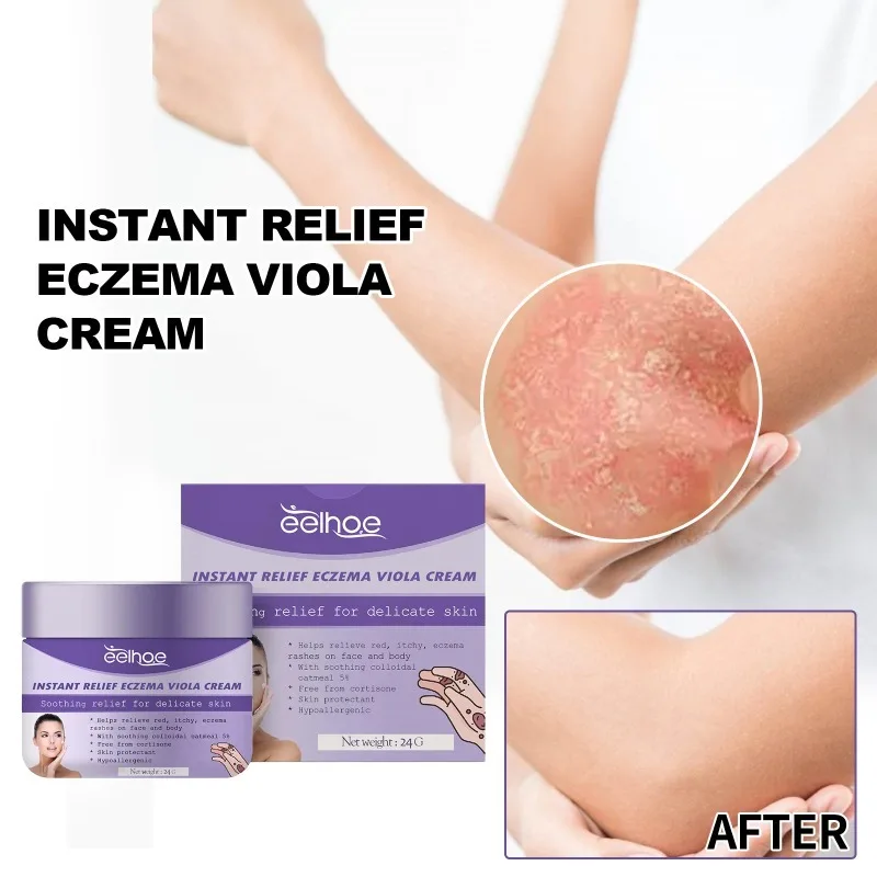 

Anti Eczema Cream Improving Redness Antibacterial Dermatitis Itching Hands Foot Tinea Relief Sooth Psoriasis Treatment Ointment