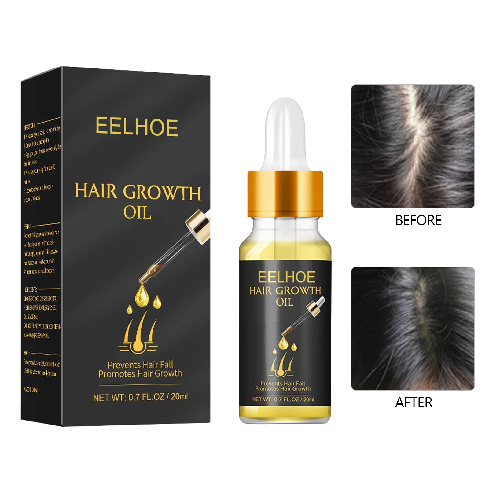 

Hair Growth Essential Oil Scalp Treatments Fast Effective Hair Regrowth Serum Thick Strong Prevent Baldness Hair Care Oils 20ml
