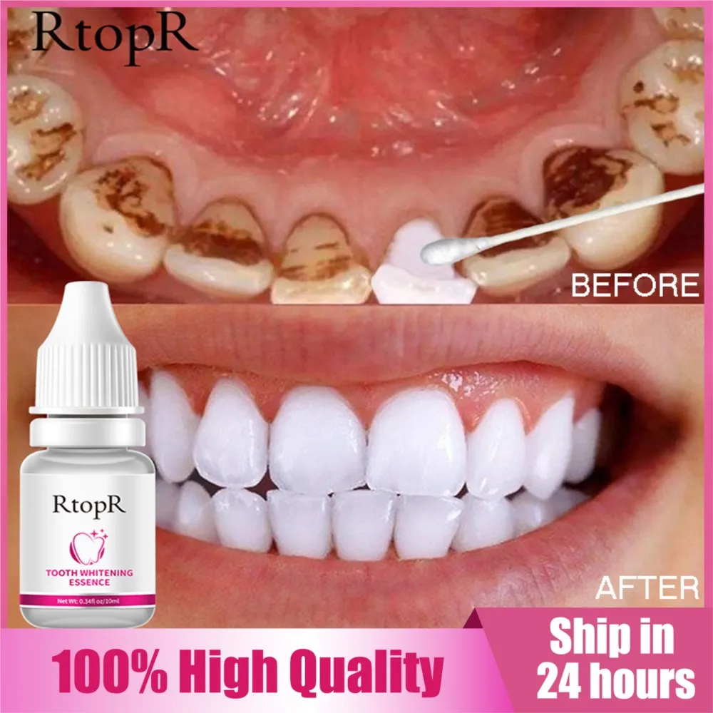 

RtopR Teeth Whitening Serum Remove Plaque Stains Rapid Bleachig Teeth Essence Oral Hygiene Cleaning Gel Fresh Breath Care Dental