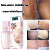 stretch mark removal essence postpartum repair care dilute scars tighten abdomen remove stretch marks repair cream
