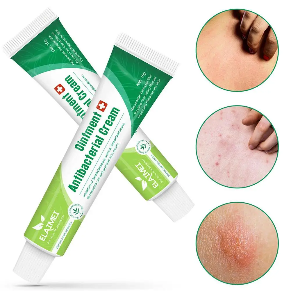 

15g Herbal Bacteriostatic Ointment Relieve Skin Itching Repair Dermatitis Eczematoid Treatment Psoriasis Itch Cream Skin Care