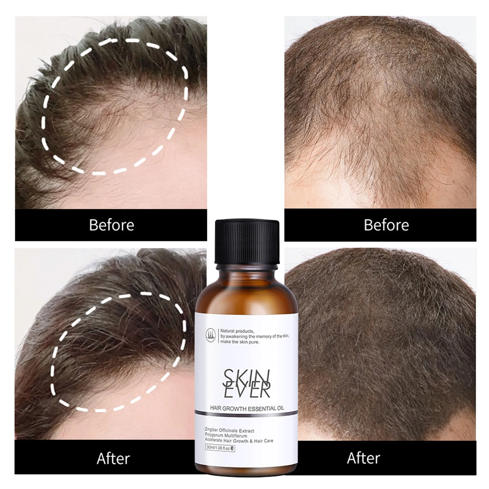 

Эфирное масло для роста волос Восстановление роста волос, сыворотка против выпадения волос, предотвращение облысения, уход за волосами 30mlS