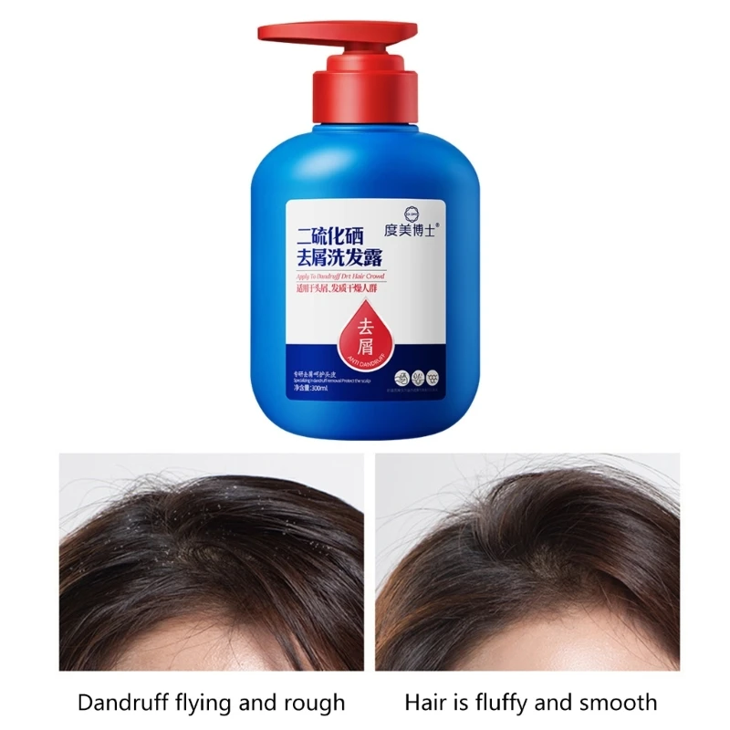 

300ml Selenium Disulfide Shampoo Smoothing Moisturize Anti-Dandruff Itching Anti-hair Loss Oil Control Nourishing Hair R3MF