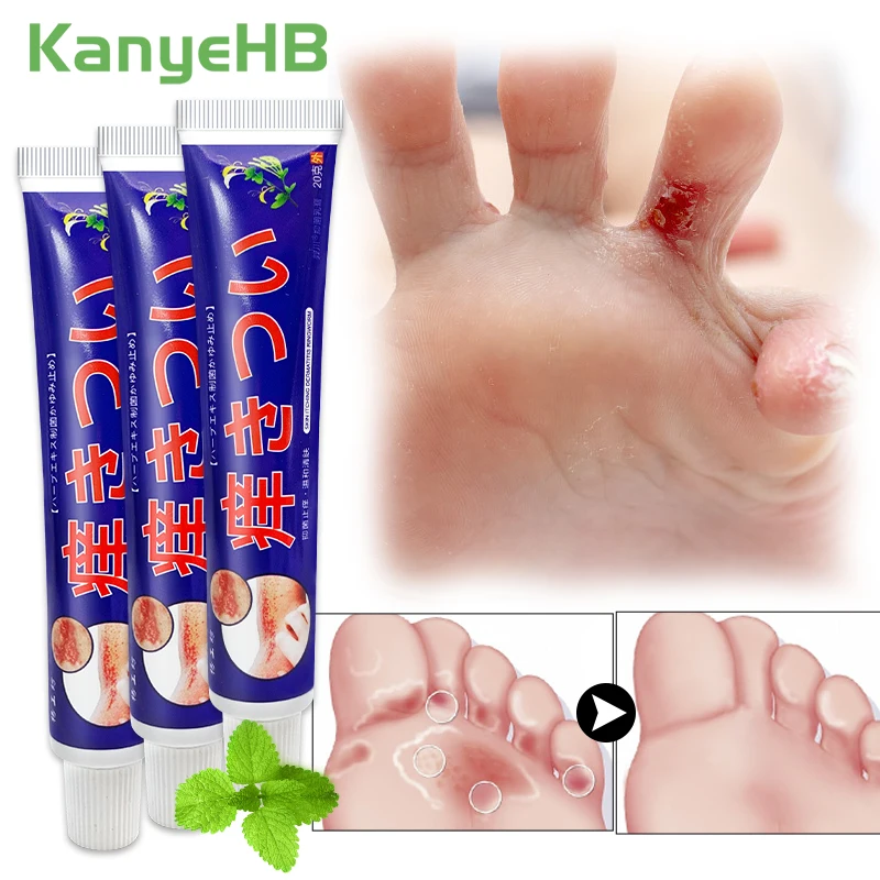 

1-3-6pcs Psoriasis Cream Menthol Cooling Cream Inhibits Skin Fungus Anti-itch Rash Eczema Dermatitis Beriberi Care Ointment