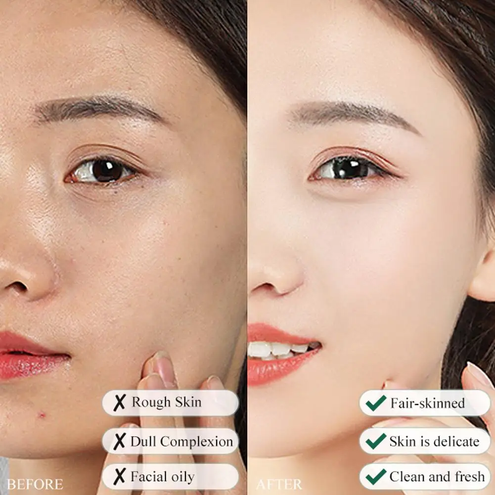 Рисунок 5 - Отшелушивающий гель