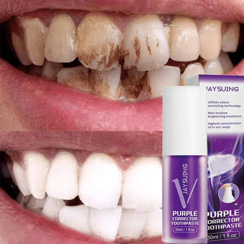 Teeth Cleansing Whitening Purple Toothpaste Removes Stains Fresh Breath Repairing Decayed Teeth Oral Hygiene Teeth Care Products