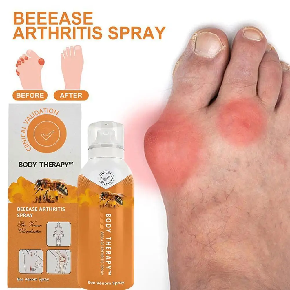 Спрей для лечения суставов и костей 60 мл