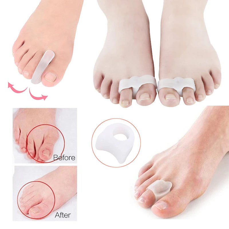 

Silicone Toe Separator Bunion Splint Corrector Hallux Valgus Orthosis Correction Overlapping Spreader Foot Protector Inserts