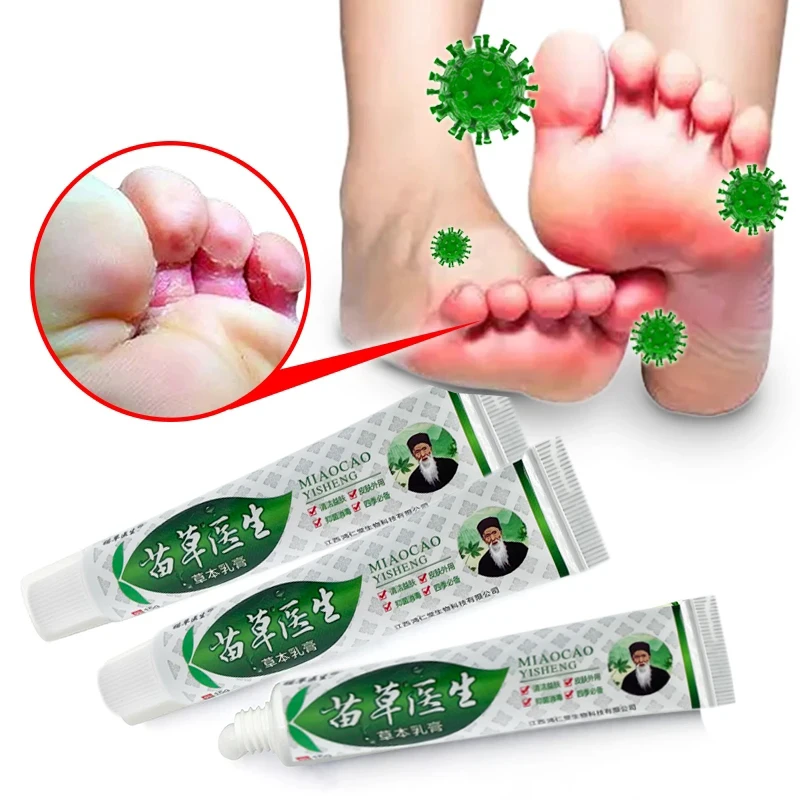 

3 шт. крем для ног берибери лечение берибери мазь анти-зуд ингибирует грибковый пилинг спортсмена ног медицинский крем 15 г