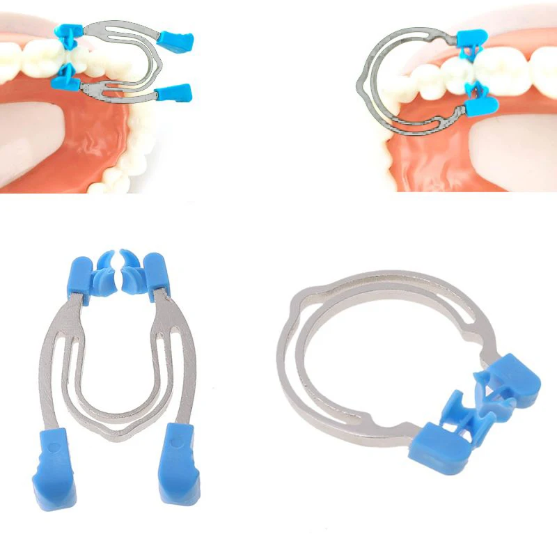 

Стоматологический секционный резной металлический кольцевой пружинный зажим для замены зубов, стоматологические инструменты, стоматологический лабораторный инструмент